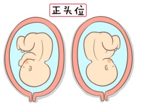 唐筛攻略：孕妇需警惕18-三体综合征致畸的风险！