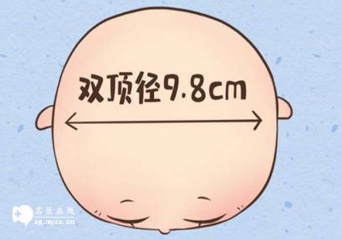 双胞胎比单胎更早测出怀孕吗,怀孕初期如何判断双胞胎